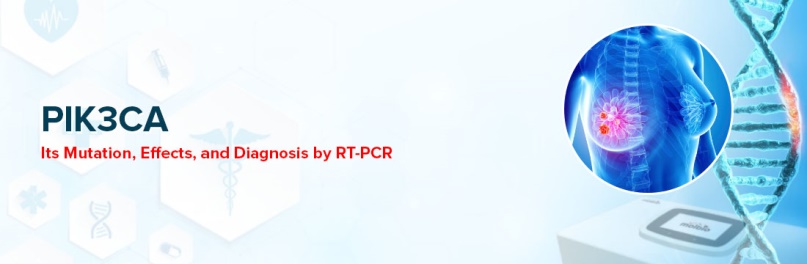 Scared of Your Breast Lump? Diagnose Malignancy by Latest Technology RT-PCR